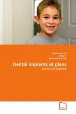Dental implants at glans : Review on Implants （2011. 64 S.）