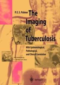 The Imaging of Tuberculosis : With Epidemiological, Pathological, and Clinical Correlation （Softcover reprint of the original 1st ed. 2002. 2012. x, 145 S. X, 145）
