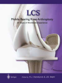 LCS® Mobile Bearing Knee Arthroplasty : A 25 Years Worldwide Review