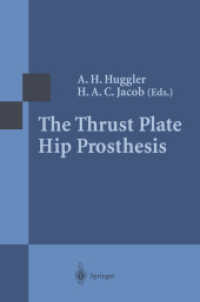 The Thrust Plate Hip Prosthesis （Reprint）