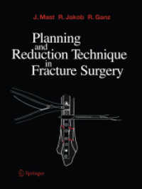Planning and Reduction Technique in Fracture Surgery （Softcover reprint of the original 1st ed. 1989. 2011. xiv, 254 S. XIV,）