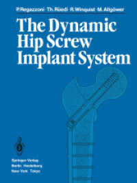 The Dynamic Hip Screw Implant System （Reprint）