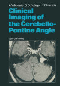 Clinical Imaging of the Cerebello-Pontine Angle （Reprint）
