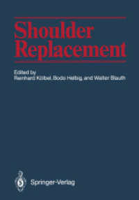 Shoulder Replacement （Reprint）