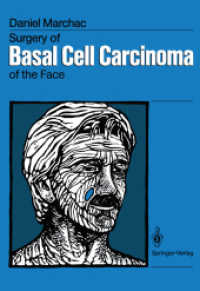 Surgery of Basal Cell Carcinoma of the Face （Reprint）