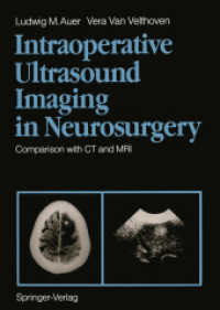 Intraoperative Ultrasound Imaging in Neurosurgery : Comparison with Ct and MRI （Reprint）