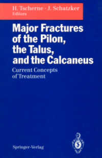 Major Fractures of the Pilon, the Talus, and the Calcaneus : Current Concepts of Treatment （Reprint）