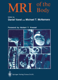 MRI of the Body （Softcover reprint of the original 1st ed. 1989. 2012. xxiii, 387 S. XX）
