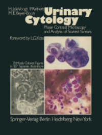 Urinary Cytology : Phase Contrast Microscopy and Analysis of Stained Smears （Reprint）