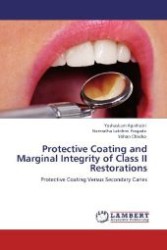 Protective Coating and Marginal Integrity of Class II Restorations : Protective Coating Versus Secondary Caries （Aufl. 2012. 68 S. 220 mm）
