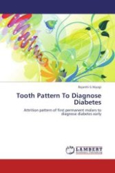 Tooth Pattern To Diagnose Diabetes : Attrition pattern of first permanent molars to diagnose diabetes early （Aufl. 2012. 96 S.）
