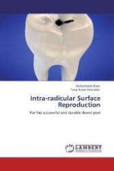 Intra-radicular Surface Reproduction : For the successful and durable dowel post （Aufl. 2012. 52 S. 220 mm）