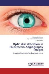 Optic disc detection in Fluorescein Angiography Images : Analysis of optic disc localization in retina （Aufl. 2012. 140 S. 220 mm）