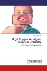 High Copper Amalgam Alloys in Dentistry : High Copper Amalgam Alloys （Aufl. 2012. 100 S. 220 mm）