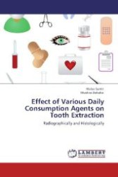 Effect of Various Daily Consumption Agents on Tooth Extraction : Radiographically and Histologically （Aufl. 2012. 180 S. 220 mm）