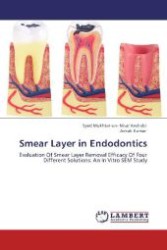 Smear Layer in Endodontics : Evaluation Of Smear Layer Removal Efficacy Of Four Different Solutions: An In Vitro SEM Study （Aufl. 2012. 112 S. 220 mm）