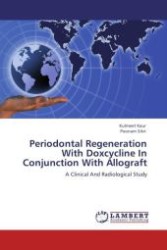 Periodontal Regeneration With Doxcycline In Conjunction With Allograft : A Clinical And Radiological Study （Aufl. 2012. 112 S.）