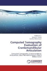 Computed Tomography Evaluation of Craniomandibular Articulation : Computed Tomography, Craniomandibular Articulation, Class I Normal Occlusion, Class II Malocclusion （Aufl. 2012. 76 S. 220 mm）