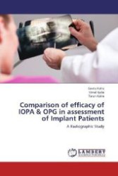 Comparison of efficacy of IOPA & OPG in assessment of Implant Patients : A Radiographic Study （Aufl. 2012. 128 S. 220 mm）