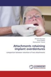 Attachments retaining implant overdentures : comparison between retention of two attachments （Aufl. 2012. 128 S. 220 mm）