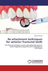 Re-attachment techniques for anterior fractured teeth : The fracture strength recovery of reattached anterior tooth fragment using different re-attachment techniques （Aufl. 2012. 80 S. 220 mm）