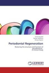 Periodontal Regeneration : Restoring the structure and function of periodontium- A Clinical Study （Aufl. 2012. 100 S.）