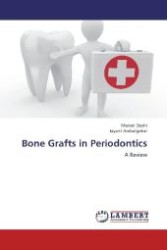 Bone Grafts in Periodontics : A Review （2012. 156 S. 220 mm）