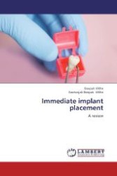 Immediate implant placement : A review （2012. 204 S. 220 mm）