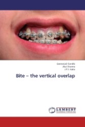 Bite - the vertical overlap （2013. 188 S. 220 mm）