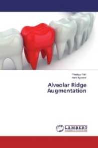 Alveolar Ridge Augmentation （2017. 200 S. 220 mm）