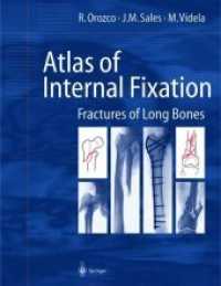 Atlas of Internal Fixation : Fractures of Long Bones （Reprint）