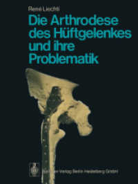 Die Arthrodese des Hüftgelenkes und ihre Problematik （Softcover reprint of the original 1st ed. 1974. 2014. xviii, 272 S. XV）