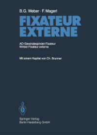 Fixateur Externe : AO-Gewindespindel-Fixateur Wirbel-Fixateur externe
