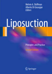 Liposuction : Principles and Practice （2ND）