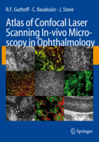 Atlas of Confocal Laser Scanning In-vivo Microscopy in Ophthalmology