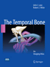 Temporal Bone : An Imaging Atlas
