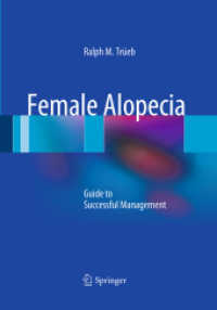 Female Alopecia : Guide to Successful Management