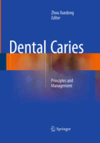 Dental Caries : Principles and Management