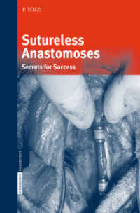 Sutureless Anastomoses : Secrets for Success