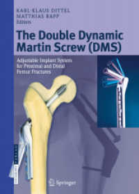 The Double Dynamic Martin Screw (DMS) : Adjustable Implant System for Proximal and Distal Femur Fractures