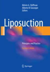 Liposuction : Principles and Practice （2ND）