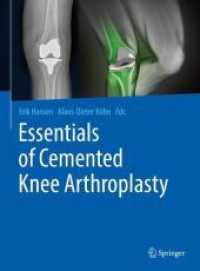 Essentials of Cemented Knee Arthroplasty （2021. xxiii, 790 S. XXIII, 790 p. 355 illus., 239 illus. in color. 279）