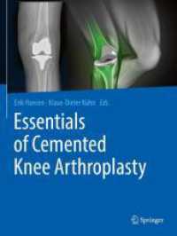 Essentials of Cemented Knee Arthroplasty （2022. xxiii, 790 S. XXIII, 790 p. 355 illus., 239 illus. in color. 279）