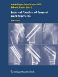 Internal fixation of femoral neck fractures : An Atlas
