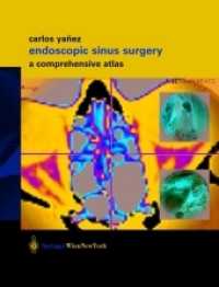 Endoscopic Sinus Surgery : A Comprehensive Atlas