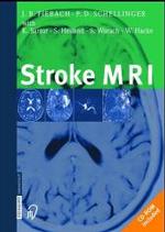 Stroke MRI, w. CD-ROM （2003. IX, 119 p. w. 59 ill.）