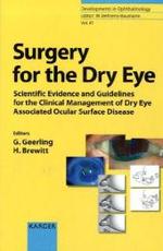 Surgery for the Dry Eye : Scientific Evidence and Guidelines for the Clinical Management of Dry Eye Associated Ocular Surface Disease (Developments in Ophthalmology Vol.41) （2008. 320 p. w. 31 tables.）