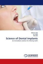 Science of Dental Implants : An Immediate solution for Missing teeth （2011. 144 S.）