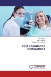 Post Endodontic Restorations （2012. 88 S. 220 mm）