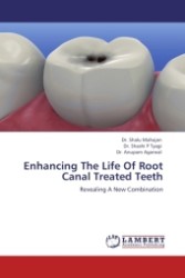 Enhancing The Life Of Root Canal Treated Teeth : Revealing A New Combination （2011. 84 S.）